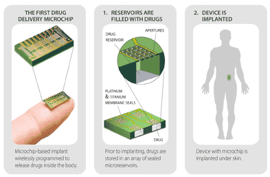 MicroCHIPS_Device