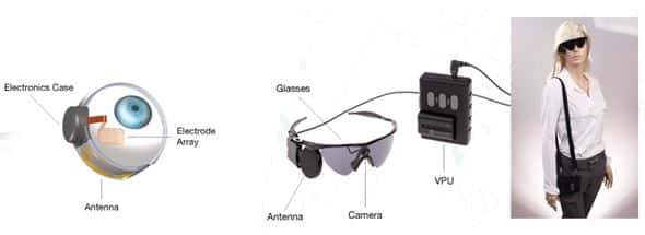 Second_Sight_Bionic_Eye