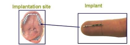 BrainsGate_Product