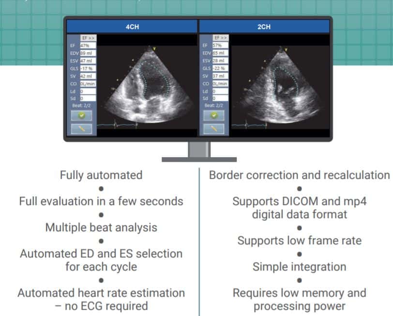 DiACardio Medical Image of Heart Analysis