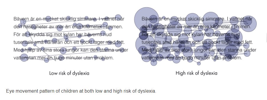 Eye movement pattern of children at both low and high risk of dyslexia