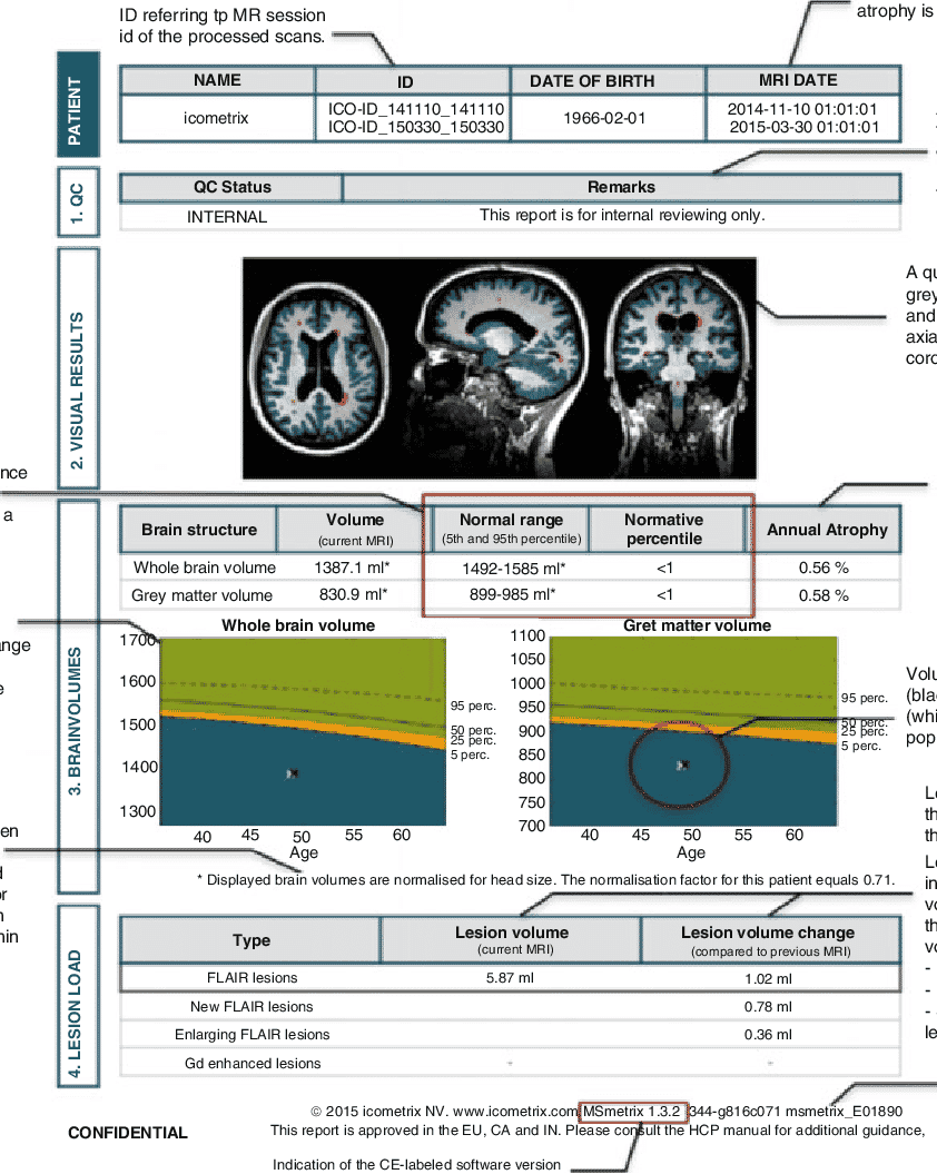Icometrix Medical Imaging Results