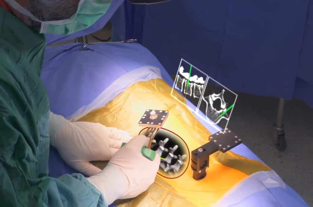 Augmedics' AR platform turns surgery into a game of Operation. But with less noise.