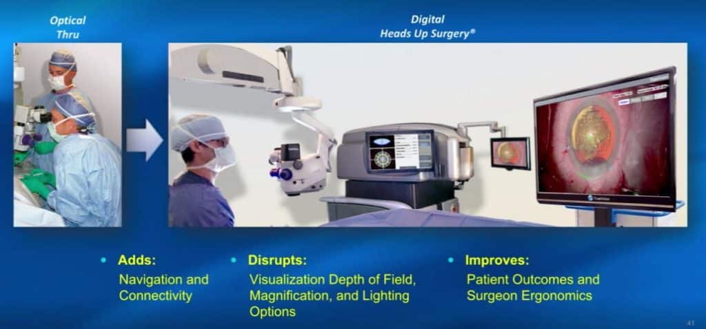augmented reality in surgery: TrueVision is turning optical surgery into digital surgery using augmented reality and other technologies. 