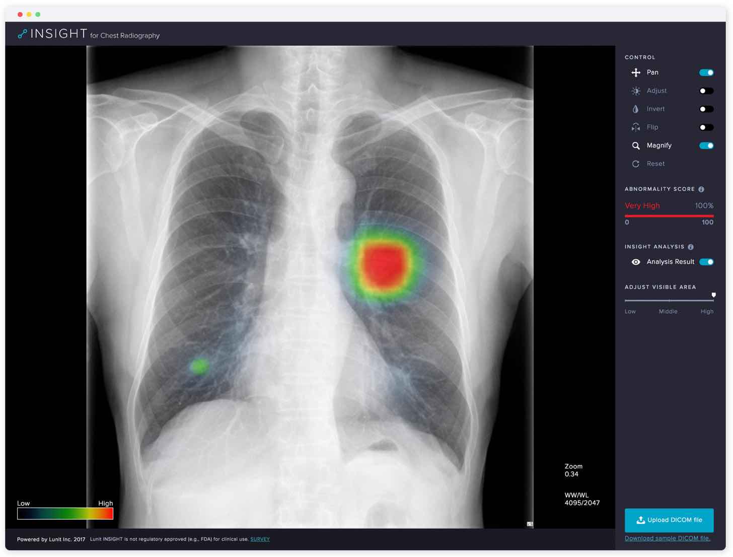 Lunit's AI algorithm analyzing chest x-ray