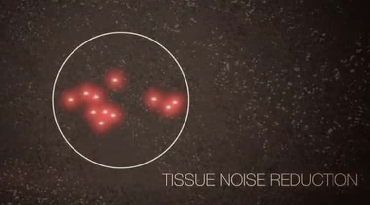 In an experiment involving mice the nanodiamonds shine like a beacon from the animal’s lymph nodes. 