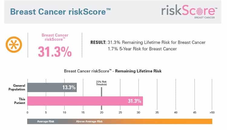 Polygenic risk score for breast cancer.