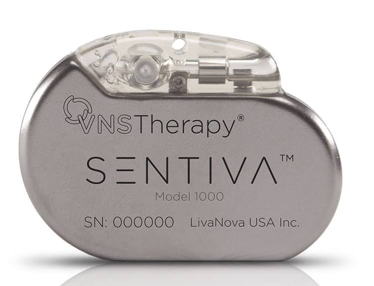 Neutraceuticals device for treating epilepsy.