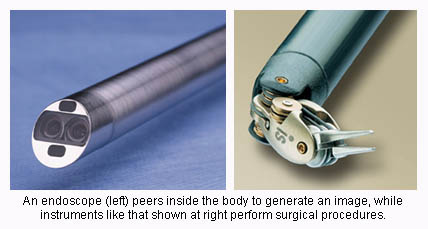 Endoscopic surgery