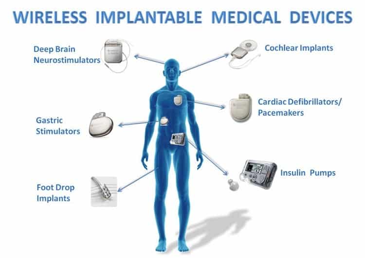Wireless implantable medical devices