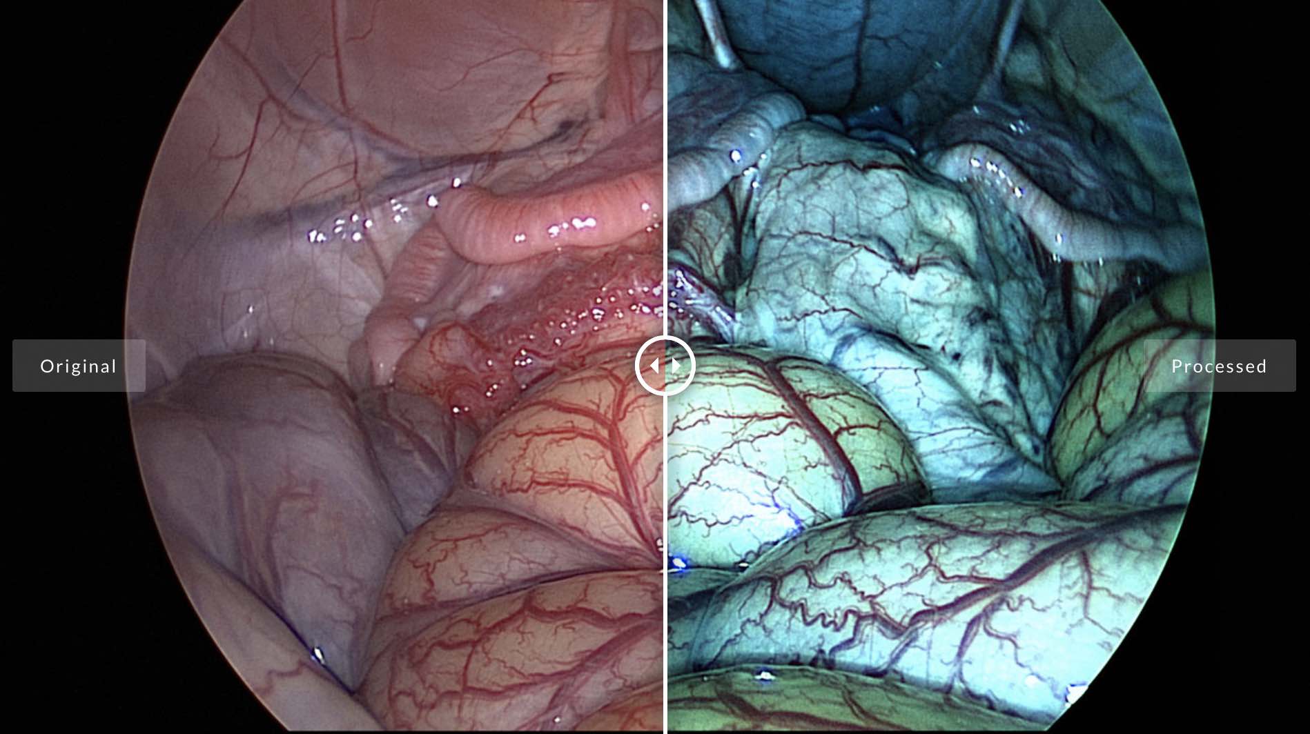 Percieve3d highlights anatomic elements with contrasting colors to make diagnostics and surgery easier