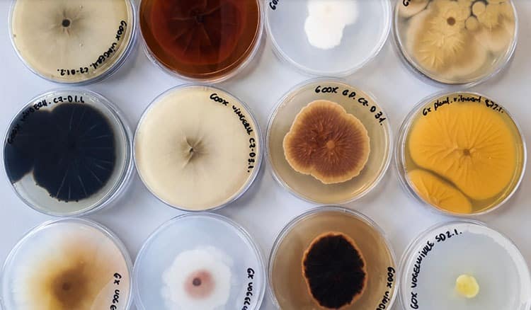 Images of bacterial cultures.