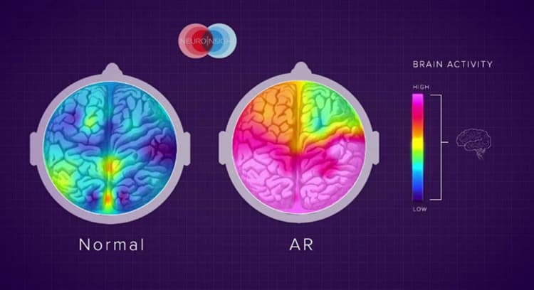 Brain scans of people who experienced AR media versus non-AR.