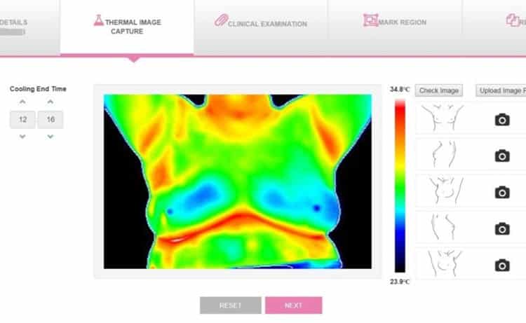 The Nirami SMILE web interface for detecting breast cancer.