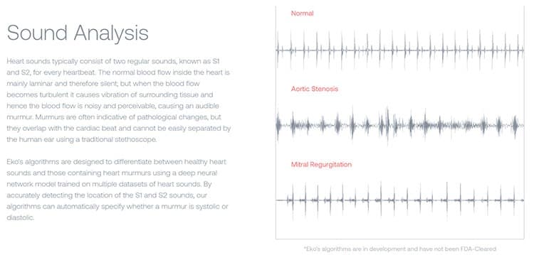 Sound analysis explanation for Eko.