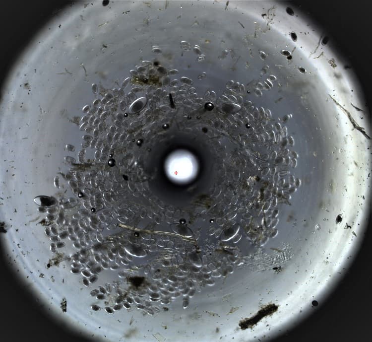 Parasite eggs 