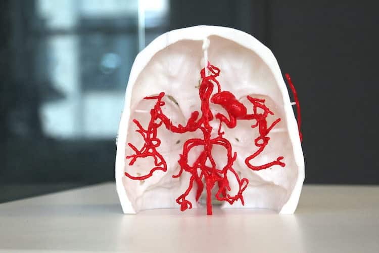 Axial3D's use cases include gaining informed consent from patients, pre-operative planning, and practicing procedures before live surgery.
