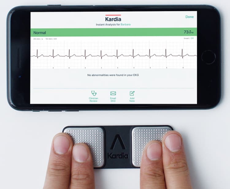 AliveCor KardiaMobile device and app.