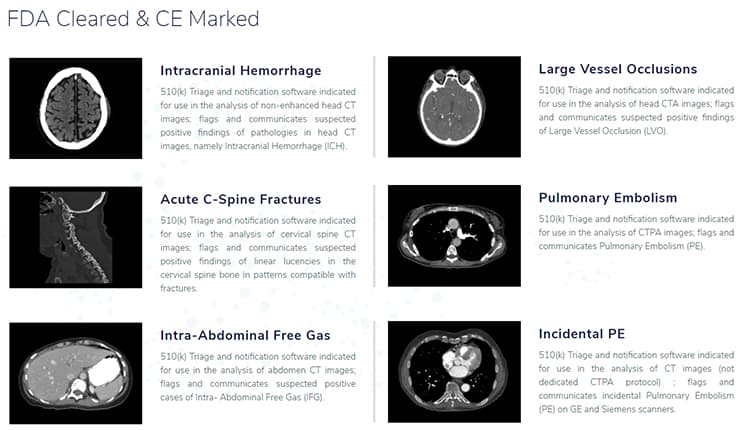 FDA-approved algorithms from Aidoc.