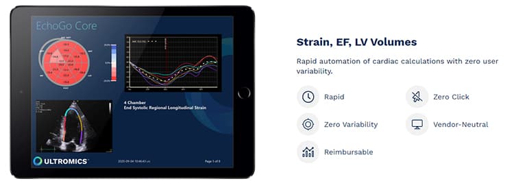 Ultromics uses AI to measure and monitor heart function.