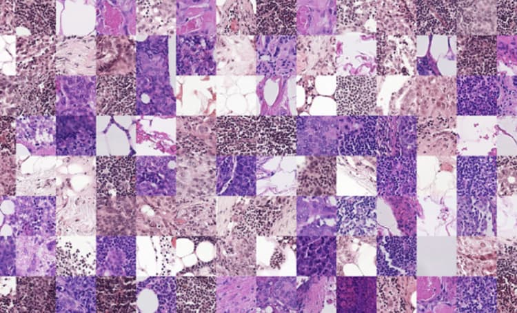 Synthetic data of brain tumor scans.