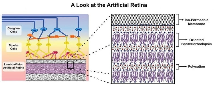 a look at LamdaVision's Artificial Retina. Credit: LambdaVision