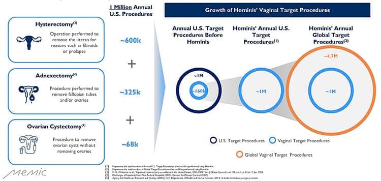 TAM for transvaginal procedures.