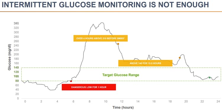Constant glucose monitoring vs. intermittent glucose monitoring 